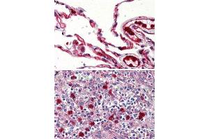 Immunohistochemistry (Formalin/PFA-fixed paraffin-embedded sections) of human lung (A) and human spleen, red pulp (B) tissue with GPR132 polyclonal antibody . (G Protein-Coupled Receptor 132 抗体  (Cytoplasmic Domain))