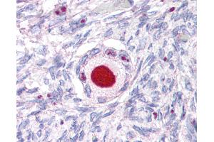 Immunohistochemistry (IHC) image for anti-Nuclear Receptor Subfamily 5, Group A, Member 1 (NR5A1) (Internal Region) antibody (ABIN1049145)