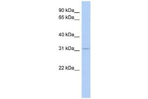 AES antibody used at 0. (AES 抗体  (Middle Region))