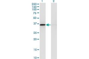 Western Blot analysis of MDH1 expression in transfected 293T cell line by MDH1 monoclonal antibody (M03), clone 1D2. (MDH1 抗体  (AA 101-193))