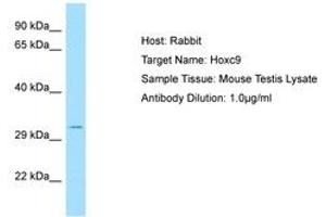 Image no. 1 for anti-Homeobox C9 (HOXC9) (C-Term) antibody (ABIN6749849) (HOXC9 抗体  (C-Term))