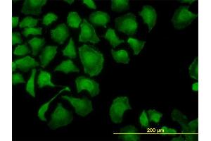 Immunofluorescence (IF) image for anti-TROVE Domain Family, Member 2 (TROVE2) (AA 1-100) antibody (ABIN563007)