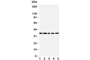 Western blot testing of IRF1 antibody and Lane 1:  COLO320;  2: U87;  3: HeLa;  4: Jurkat;  5: MCF-7 cell lysate