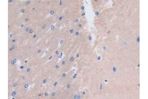 Immunohistochemistry (IHC) image for anti-Myosin, Light Chain 3 (MYL3) (AA 8-199) antibody (ABIN7443521)