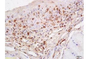 Formalin-fixed and paraffin embedded rat tongue labeled with Anti-RASA3 Polyclonal Antibody, Unconjugated (ABIN760316) at 1:200 followed by conjugation to the secondary antibody and DAB staining (RASA3 抗体  (AA 501-600))