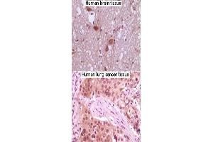 Immunohistochemical analysis of paraffin-embedded human brain tissue and lung carcinoma tissue, showing nuclear/cytoplasmic localization using MAPK10 monoclonal antibody, clone 8A5D11  with DAB staining. (MAPK10 抗体)