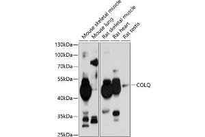 Western blot analysis of extracts of various cell lines, using COLQ antibody (ABIN6131427, ABIN6138859, ABIN6138860 and ABIN6214704) at 1:1000 dilution. (COLQ 抗体  (AA 276-455))