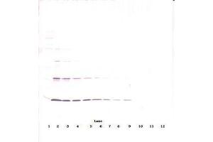 Image no. 3 for anti-Leptin (LEP) antibody (ABIN465530) (Leptin 抗体)