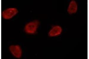 ABIN6269396 staining Hela by IF/ICC. (HDAC8 抗体  (N-Term))