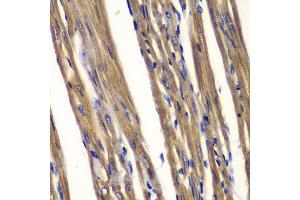 Immunohistochemistry of paraffin-embedded rat heart using PTPN2 antibody at dilution of 1:100 (400x lens). (PTPN2 抗体)