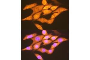 Immunofluorescence analysis of NIH-3T3 cells using FGF1 Rabbit mAb (ABIN7267182) at dilution of 1:100 (40x lens). (FGF1 抗体)