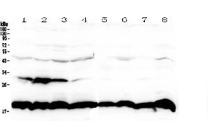 Western blot analysis of Cyclophilin B using anti-Cyclophilin B antibody . (PPIB 抗体  (AA 158-216))