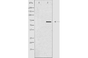 Western blot analysis of extracts from Jurkat cells, using TBX18 antibody. (T-Box 18 抗体  (Internal Region))