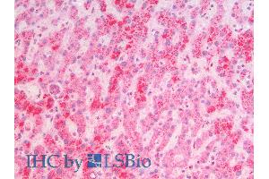 ABIN2613452 (5µg/ml) staining of paraffin embedded Human Liver. (MSI2 抗体  (N-Term))