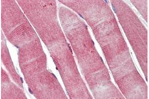 Human Skeletal Muscle: Formalin-Fixed, Paraffin-Embedded (FFPE) (PGAM2 抗体)