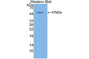 Western Blotting (WB) image for anti-Colony Stimulating Factor 2 (Granulocyte-Macrophage) (CSF2) (AA 18-144) antibody (ABIN3209610) (GM-CSF 抗体  (AA 18-144))