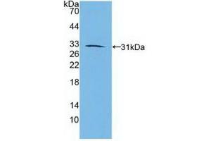 Western blot analysis of recombinant Human RARb. (Retinoic Acid Receptor beta 抗体  (AA 205-451))