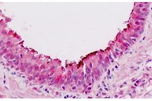 Human Lung, Respiratory Epithelium: Formalin-Fixed, Paraffin-Embedded (FFPE) (SIX4 抗体  (AA 672-781))