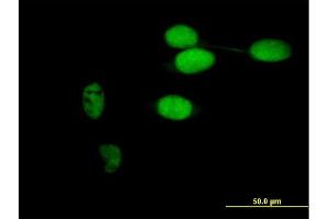 Immunofluorescence of purified MaxPab antibody to TIMELESS on HeLa cell. (TIMELESS 抗体  (AA 1-1208))