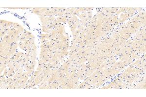 Detection of PARP4 in Human Cardiac Muscle Tissue using Polyclonal Antibody to Poly ADP Ribose Polymerase 4 (PARP4) (PARP4 抗体  (AA 338-609))