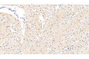 Detection of PARP4 in Human Cardiac Muscle Tissue using Polyclonal Antibody to Poly ADP Ribose Polymerase 4 (PARP4) (PARP4 抗体  (AA 338-609))