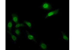 Detection of FADS2 in Human HepG2 cell using Polyclonal Antibody to Fatty Acid Desaturase 2 (FADS2) (FADS2 抗体  (AA 1-130))