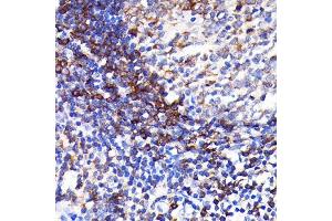 Immunohistochemistry of paraffin-embedded human appendix using SHP1 Rabbit mAb (ABIN7269716) at dilution of 1:100 (40x lens). (SHP1 抗体)