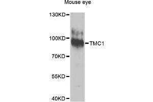 Western blot analysis of extracts of mouse eye, using TMC1 antibody.