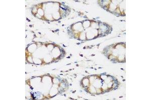 Immunohistochemistry of paraffin-embedded human colon using BMP2 antibody. (BMP2 抗体  (AA 283-396))