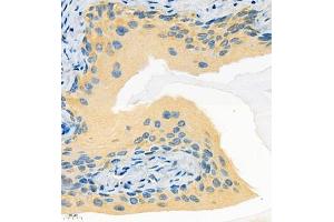 Immunohistochemistry of paraffin embedded mouse bladder using Tnfaip2 (ABIN7076074) at dilution of 1:600 (400x lens)