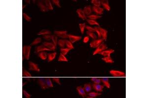Immunofluorescence analysis of HeLa cells using SFRP4 Polyclonal Antibody (SFRP4 抗体)