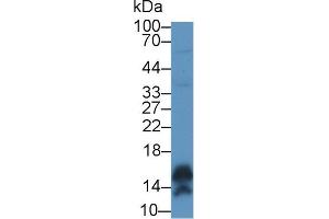 Western blot analysis of Human A431 cell lysate, using Human CALML5 Antibody (1 µg/ml) and HRP-conjugated Goat Anti-Rabbit antibody ( (CALML5 抗体  (AA 1-146))