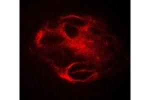 Immunofluorescent analysis of RBAT staining in Hela cells. (SLC3A1 抗体)