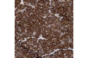 Immunohistochemical staining of human pancreas with UFL1 polyclonal antibody  shows strong cytoplasmic positivity in exocrine glandular cells at 1:20-1:50 dilution. (UFL1 抗体)