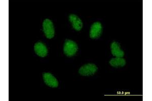 Immunofluorescence of purified MaxPab antibody to NSMCE1 on HeLa cell. (NSMCE1 抗体  (AA 1-256))