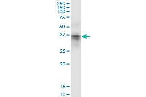 Immunoprecipitation of ASPA transfected lysate using anti-ASPA MaxPab rabbit polyclonal antibody and Protein A Magnetic Bead , and immunoblotted with ASPA purified MaxPab mouse polyclonal antibody (B01P) . (ASPA 抗体  (AA 1-313))