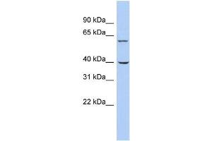 Human THP-1; WB Suggested Anti-TRIM26 Antibody Titration: 0. (TRIM26 抗体  (Middle Region))