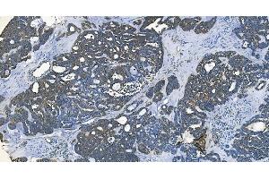 IHC analysis of GABARAP using anti-GABARAP antibody (ABIN7603159). (GABARAP 抗体  (N-Term))