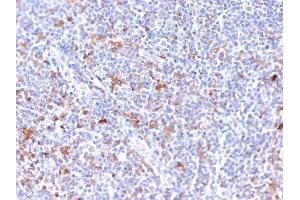 Formalin-fixed, paraffin-embedded human Tonsil stained with RCAS1 Mouse Monoclonal Antibody (CPTC-EBAG9-2). (RCAS1 抗体)