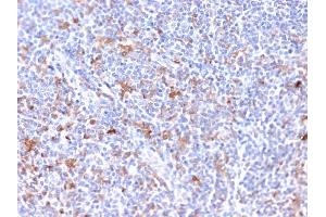 Formalin-fixed, paraffin-embedded human Tonsil stained with RCAS1 Mouse Monoclonal Antibody (CPTC-EBAG9-2). (RCAS1 抗体)