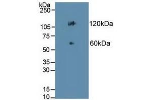Detection of CDH17 in Mouse Colon Tissue using Polyclonal Antibody to Cadherin 17 (CDH17) (LI Cadherin 抗体  (AA 67-351))