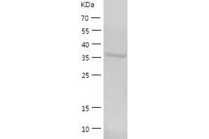 RTCD1 Protein (AA 1-366) (His tag)