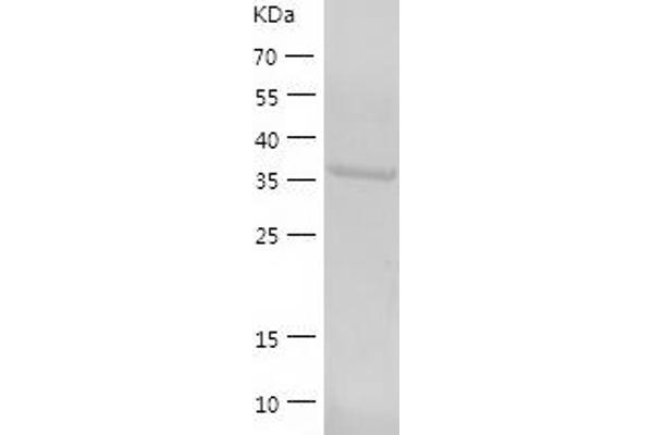 RTCD1 Protein (AA 1-366) (His tag)