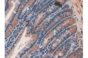 Immunohistochemistry (IHC) image for anti-Sema Domain, Immunoglobulin Domain (Ig), Short Basic Domain, Secreted, (Semaphorin) 3A (SEMA3A) (AA 31-150) antibody (ABIN7430105)