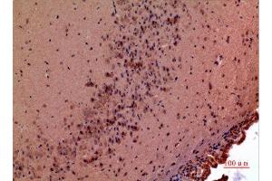 Immunohistochemistry (IHC) analysis of paraffin-embedded Mouse Brain, antibody was diluted at 1:100. (GDF5 抗体  (Internal Region))