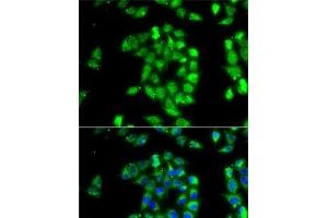 Immunofluorescence analysis of MCF7 cells using ANTXR1 Polyclonal Antibody (ANTXR1 抗体)