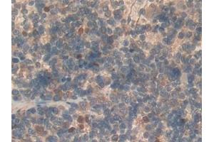 Immunohistochemistry (IHC) image for anti-Sema Domain, Immunoglobulin Domain (Ig), Short Basic Domain, Secreted, (Semaphorin) 3A (SEMA3A) (AA 31-150) antibody (ABIN7430105)