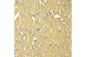 Immunohistochemistry of paraffin-embedded mouse heart using TPM3 antibody. (TPM3 抗体  (AA 1-284))