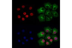 ABIN6264887 and ABIN6276947 staining Hela cells by IF/ICC.