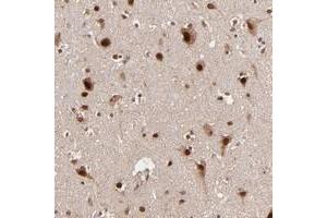 Immunohistochemical staining of human cerebral cortex with TOP1MT polyclonal antibody  shows strong nuclear and cytoplasmic positivity in neuronal cells. (TOP1MT 抗体)